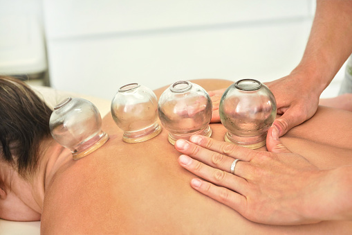 Young female physiotherapist applying glass suction banks on back of her patient, during cupping therapy, closeup detail.