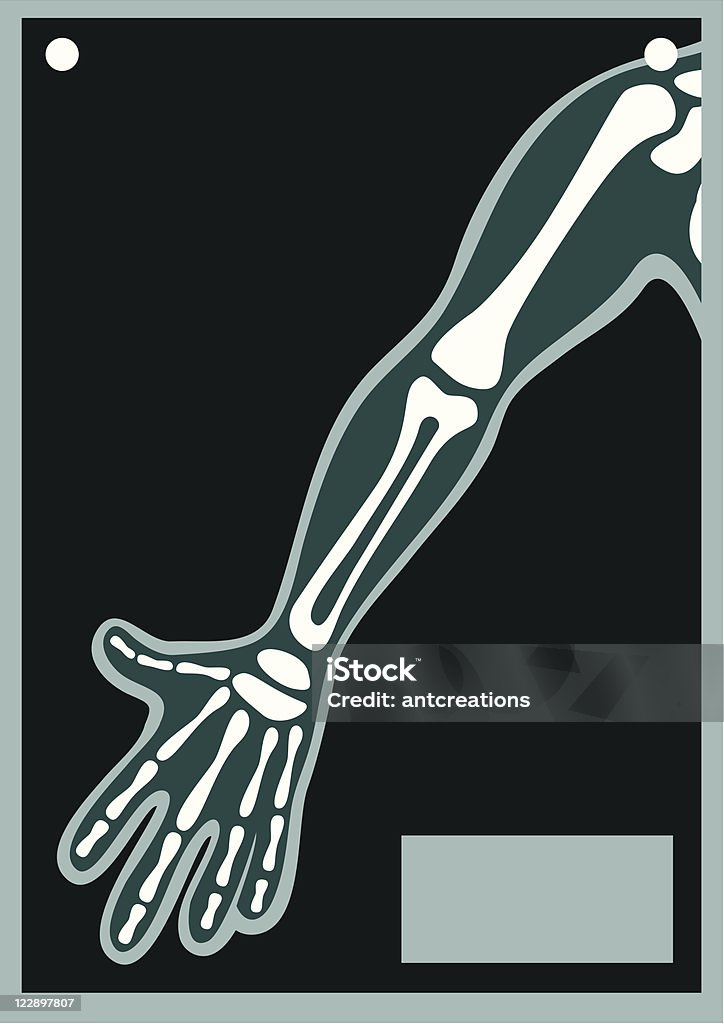 Cuerpo humano X Ray brazo - arte vectorial de Imagen de rayos X libre de derechos