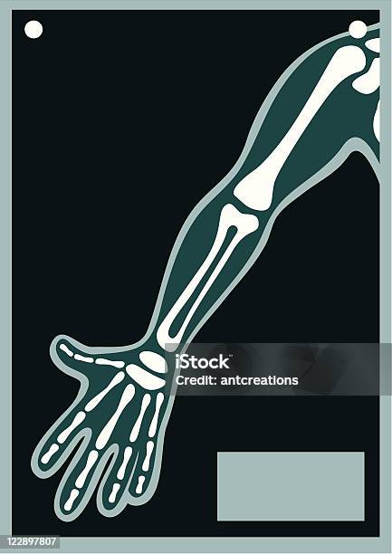 Ilustración de Cuerpo Humano X Ray Brazo y más Vectores Libres de Derechos de Imagen de rayos X - Imagen de rayos X, Húmero, Asistencia sanitaria y medicina