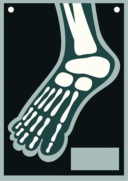 Vector illustration of Human Body X Ray Foot