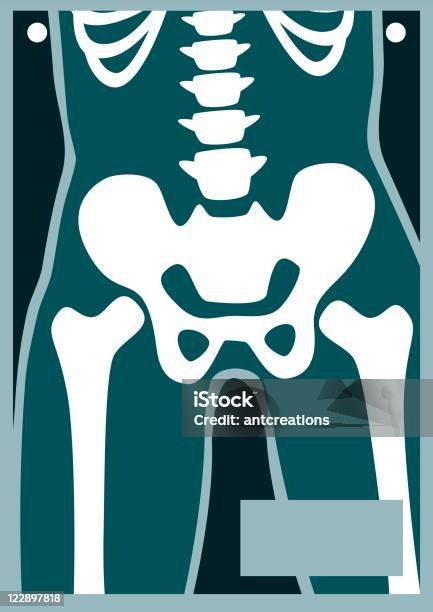 Corpo Humano Raio X Pélvis - Arte vetorial de stock e mais imagens de Coluna vertebral humana - Coluna vertebral humana, Costela, Cuidados de Saúde e Medicina