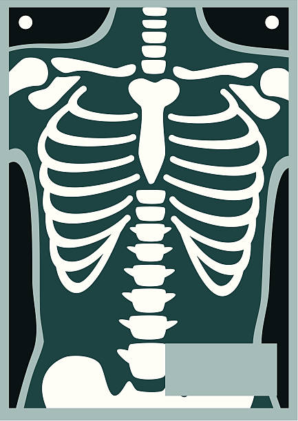 menschlichen körper x-ray rib cage - brustkorb stock-grafiken, -clipart, -cartoons und -symbole