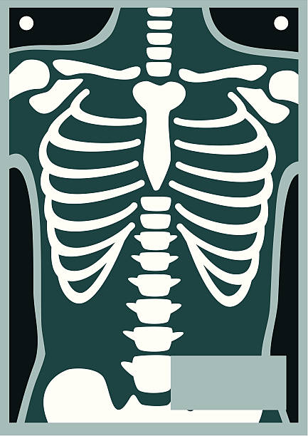 illustrazioni stock, clip art, cartoni animati e icone di tendenza di corpo umano x ray gabbia toracica - rib cage