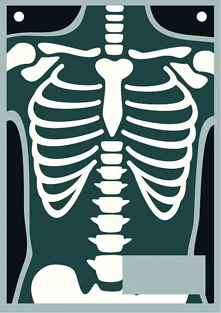 Vector illustration of Human Body X Ray Rib Cage