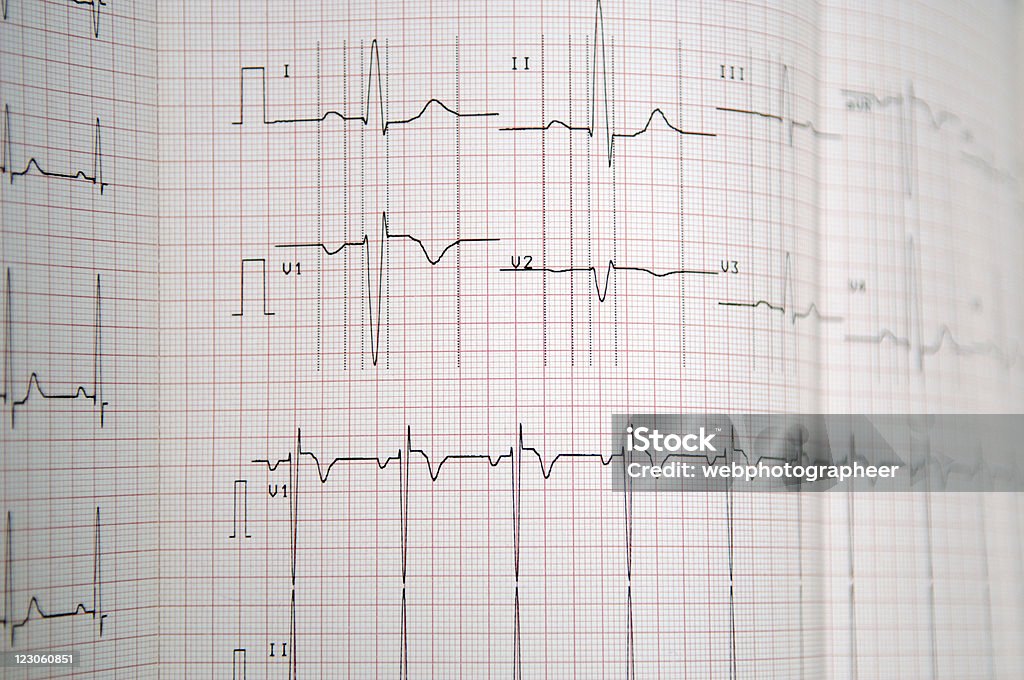 Gráfico médico - Foto de stock de Latido cardíaco libre de derechos