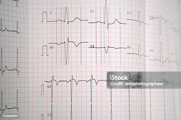 Gráfico Médico Foto de stock y más banco de imágenes de Latido cardíaco - Latido cardíaco, Asistencia sanitaria y medicina, Color - Tipo de imagen