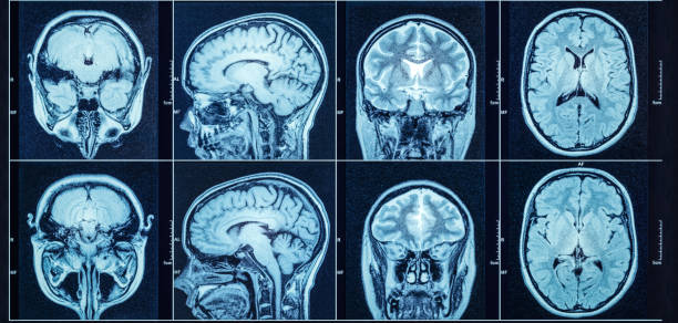 primer plano de una tomografía computarizada con cerebro. antecedentes cerebrales médicos, científicos y educativos. resonancia magnética. - mri scanner fotografías e imágenes de stock