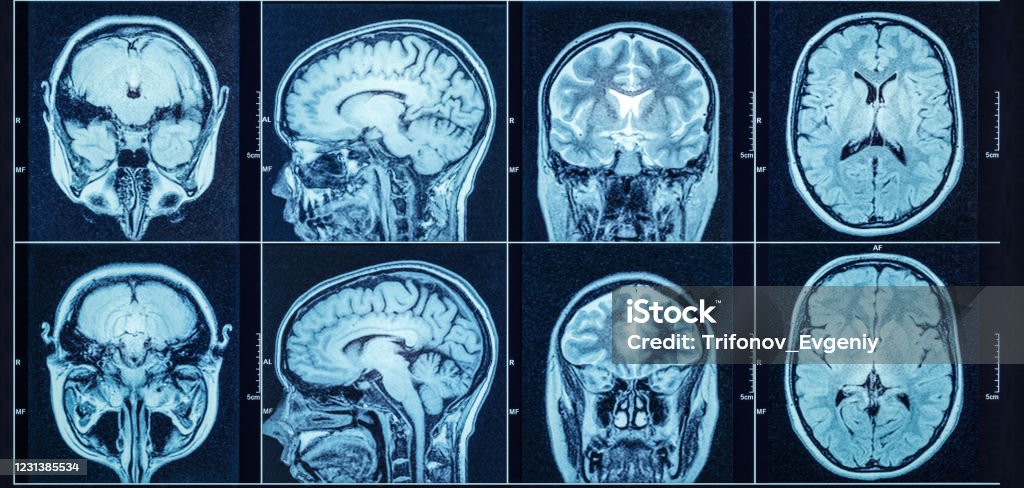 Closeup of a CT scan with brain. Medical, science and education mri brain background. Magnetic resonance imaging. MRI Scanner Stock Photo