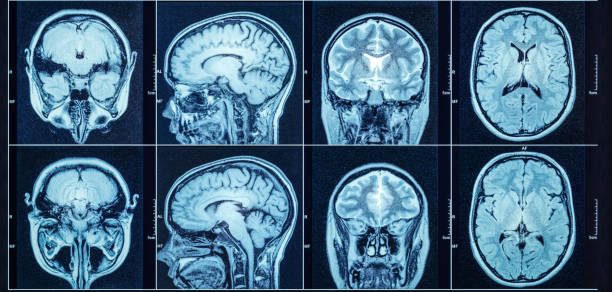 närbild av en datortomografi med hjärna. medicinsk, vetenskap och utbildning mri hjärnan bakgrund. magnetisk resonanstomografi. - brain scan' bildbanksfoton och bilder