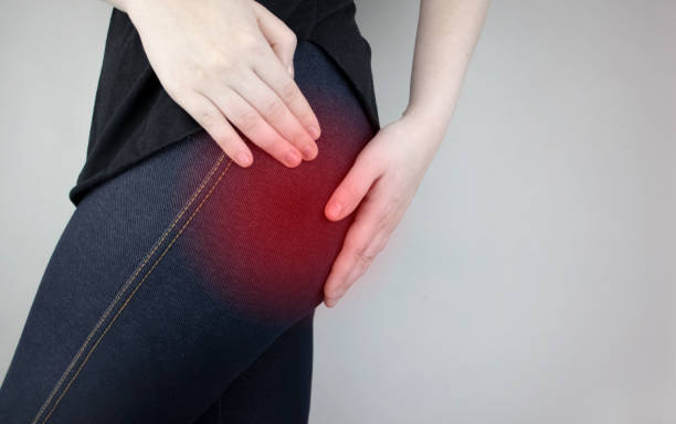 una mujer sufre de dolor en el glúteo. el médico diagnostica el síndrome de piriformis del paciente, pellizco del nervio ciático, osteocondrosis lumbar o ciática - spondylolisthesis fotografías e imágenes de stock