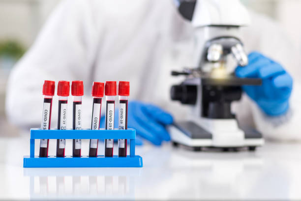 Rack of blood tubes with a label for virus identification is placed in front of a microbiologist who is working in the laboratory. stock photo