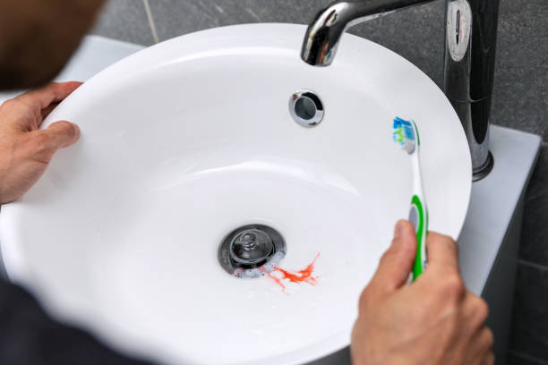 l’homme ont des gencives de saignement tout en se brossant les dents. carie dentaire et concept de gingvitis - gums photos et images de collection