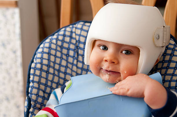 Cranial Remolding helmet worn for the treatment of plagiocephaly Cranial Remolding helmet worn for the treatment of plagiocephaly. This 9 month old child is wearing the helmet while eating solid food and wearing a bib plagiocephaly stock pictures, royalty-free photos & images