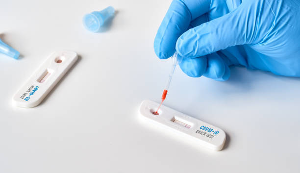 rapid covid-19 test for detection of specific antibodies igm and igg to novel corona virus sars-cov-2 that cause covid-19. medic or nurse loads blood taken from patient finger with disposable pipette. - specific imagens e fotografias de stock