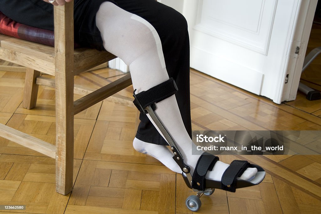 Total Knee Replacement) — przedłużanie ćwiczeń - Zbiór zdjęć royalty-free (Bandaż)