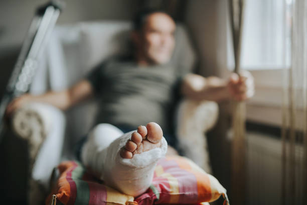 Man with broken leg at home Man with broken leg at home physical injury photos stock pictures, royalty-free photos & images