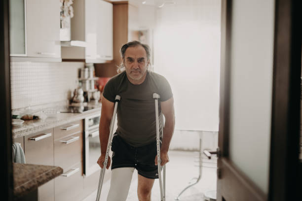 istock Man with broken leg at home 1237326960