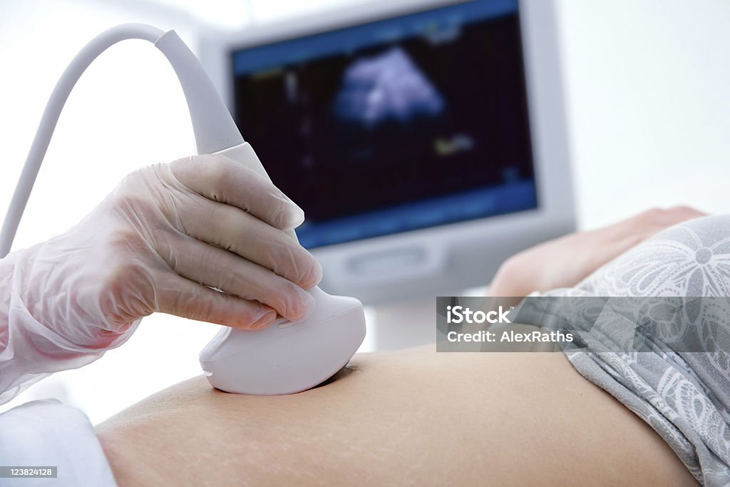 Diagnose der Schwangerschaft - Lizenzfrei Ultraschall-Untersuchung Stock-Foto