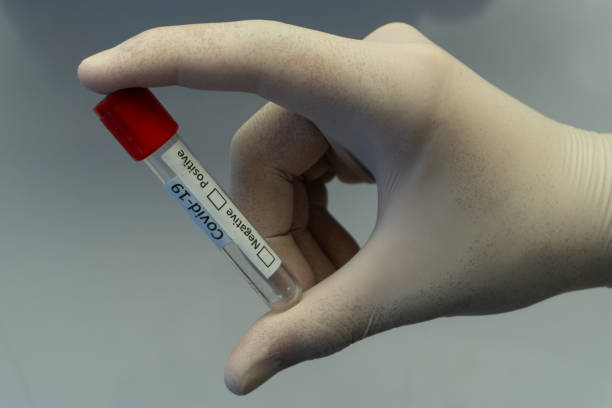 istock Empty blood tube with Coronavirus label 1238856604