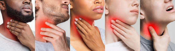 Collage Of Diverse People Having Throat Ache, Touching Inflamed Red Zone Collage Of Diverse People Having Throat Ache, Touching Inflamed Red Zone On Neck, Cropped Image, Panorama bumpy photos stock pictures, royalty-free photos & images
