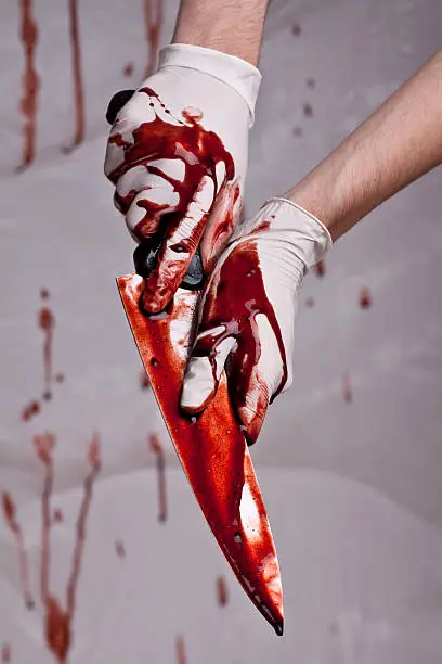 Photo of Hands holding bloody knife