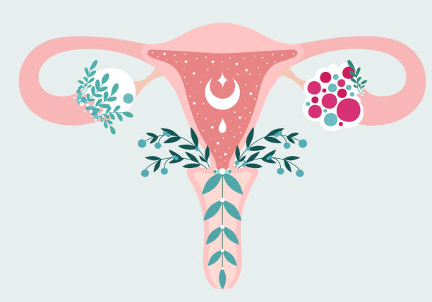 frauen gesundheit - floral infografik der polyzystischen eierstock-syndrom. patientenfreundliches schema von pcos, multifollikuläre zyste. gynäkologische probleme - neutrales medizinisches diagramm gebärmutter und gebärmutter anhängseln - ovary stock-grafiken, -clipart, -cartoons und -symbole