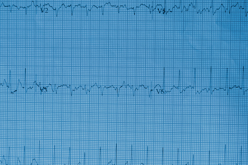 Cardiogram Chart (ECG). Close-up. Hospital.