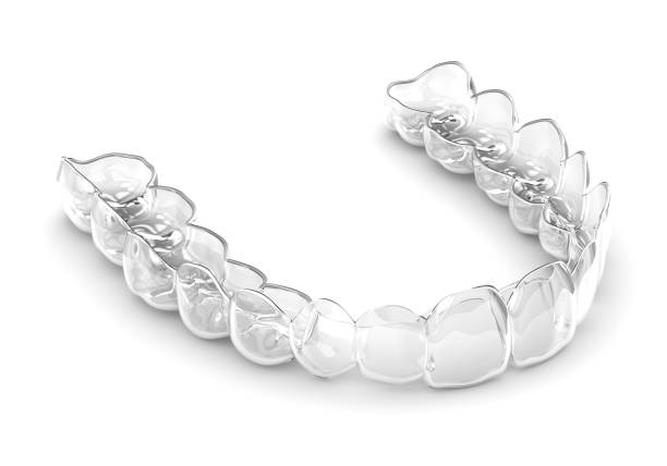 3d render de invisalign retenedor extraíble e invisible - straightener fotografías e imágenes de stock