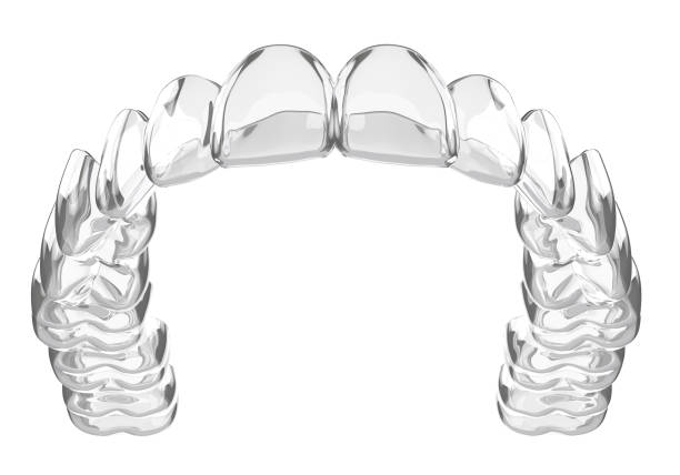 rendering 3d di fermo rimovibile e invisibile invisalign - straightener foto e immagini stock