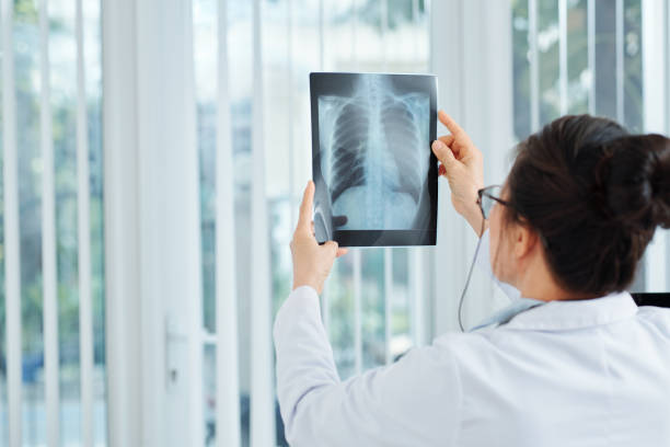 istock Possibility of lung inflammation 1239852615