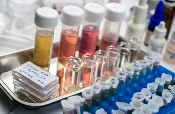 istock Samples contaminated by Clostridium botulinum toxin that causes botulism in humans, laboratory research, conceptual image 1240183272