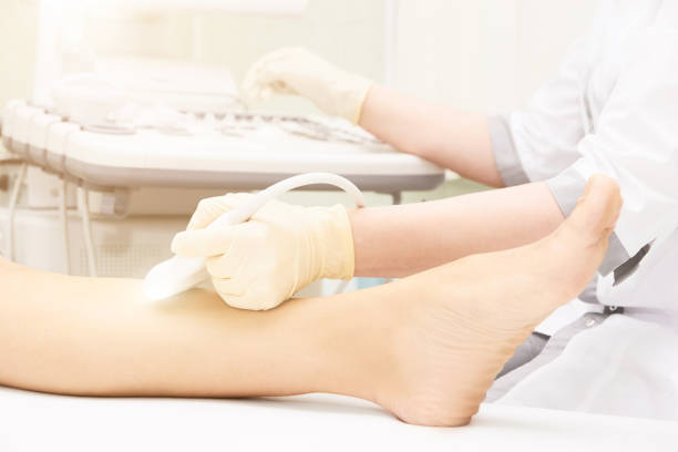 exame médico de ultrassom no joelho. escaneie o equipamento médico. diagnóstico de ultrassom - podiatry human foot podiatrist surgery - fotografias e filmes do acervo
