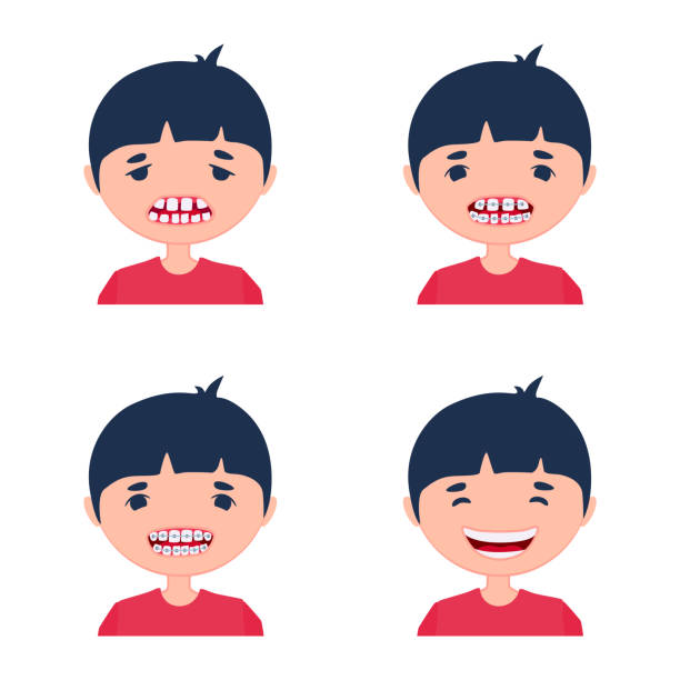 ilustrações de stock, clip art, desenhos animados e ícones de a kid before and after using dental aligner braces. corrective treatment of a child. a process of crooked teeth alignment. little boy being sad and happily smiling. - toothless grin
