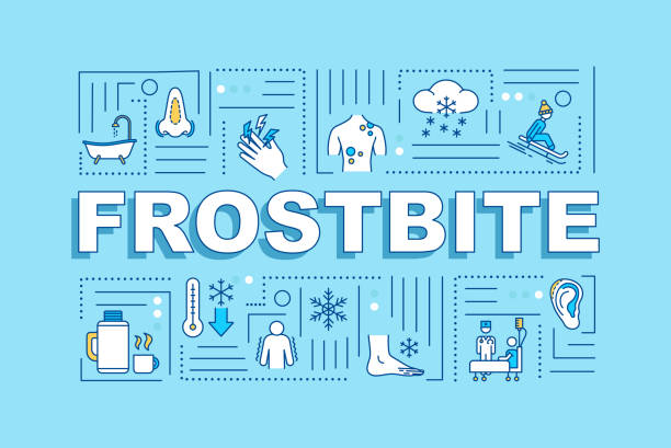 ilustrações de stock, clip art, desenhos animados e ícones de frostbite first aid and therapy, hypothermia treatment word concepts banner. infographics with linear icons on blue background. isolated typography. vector outline rgb color illustration - congelação