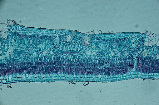 Leiden leaf c.s. under microscope