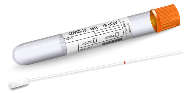 Blank test tube for diagnostics Covid 19 virus with Q-tips swab Sample. Form for blood test result Coronavirus 2019-nCoV. Realistic empty 3d Isolated on white Blank test tube for diagnostics Covid 19 virus with Q-tips swab Sample. Form for blood test result Coronavirus 2019-nCoV. Realistic empty 3d Isolated on white. Vector illustration pap smear stock illustrations