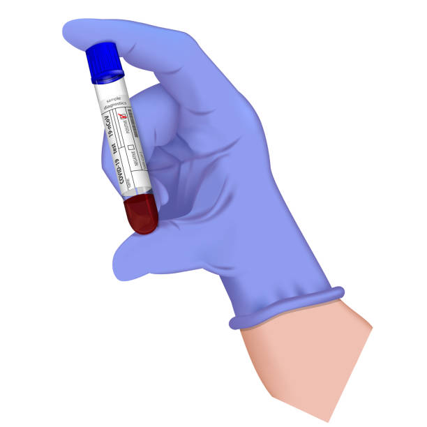 Ilustración de Mano En Guante Médico Sostiene Tubo De Prueba Con Muestra De Sangre Para El Diagnóstico Covid 19 Virus Resultado Positivo Para La Prueba Coronavirus 2019ncov Realista 3d Aislado En Blanco Ilustración de Mano En Guante Médico Sostiene Tubo De Prueba Con Muestra De Sangre Para El Diagnóstico Covid 19 Virus Resultado Positivo Para La Prueba Coronavirus 2019ncov Realista 3d Aislado En Blanco
