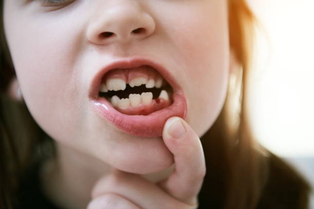 1,952 Toothless Funny Stock Photos, Pictures & Royalty-Free Images - iStock 1,952 Toothless Funny Stock Photos, Pictures & Royalty-Free Images - iStock