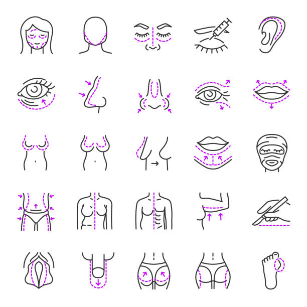 illustrazioni stock, clip art, cartoni animati e icone di tendenza di chirurgia plastica, set di icone lineari. restauro, ricostruzione o alterazione del corpo umano. eliminazione di deformazioni e difetti. chirurgia ricostruttiva e estetica. linea con tratto modificabile - plastica