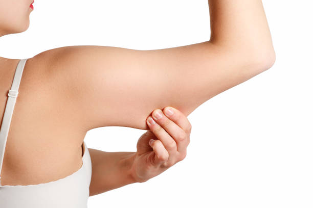 belleza retrato mujer pellizcar brazo grasa flácida piel, mano y cuidado del cuerpo. piel lisa - celulitis tipos de piel fotografías e imágenes de stock