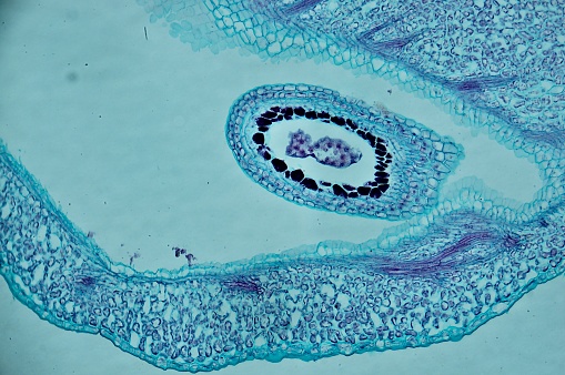 Capsella young embryo sec. under microscope