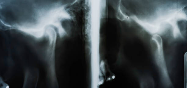 tempromandibulární kloub je kloub dolní čelistní kosti nebo čelisti. existují dva tmj, jeden na každé straně, pracující v souzvuku. - spánková-kost - stock snímky, obrázky a fotky