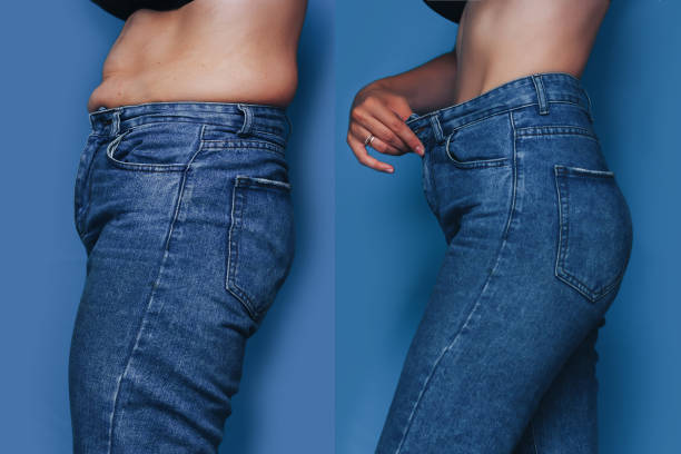 porträts von frau vor und nach von fetten bis schlanken konzept stehen blauen hintergrund - overweight tummy tuck abdomen body stock-fotos und bilder