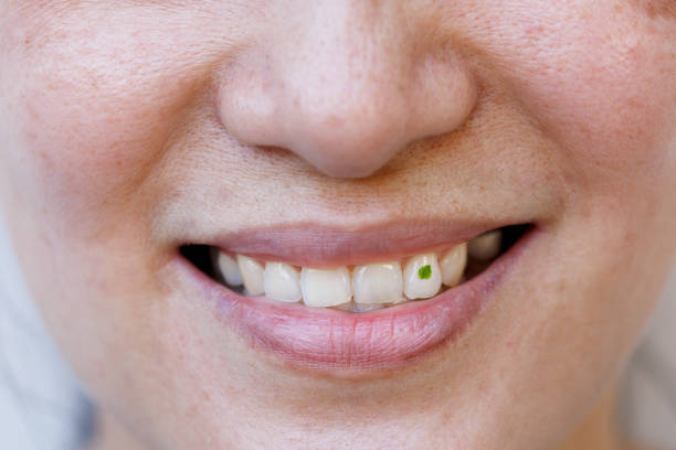 tooth and oral hygiene