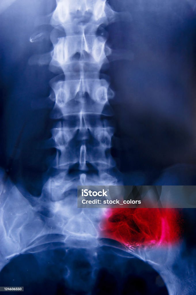 Coluna vertebral - Royalty-free Dor de Costas Foto de stock