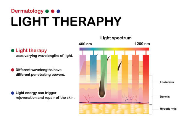 dermatologia infografika pokaż pojęcie terapii światłem na skórze o różnej długości światła - laser show illustrations stock illustrations