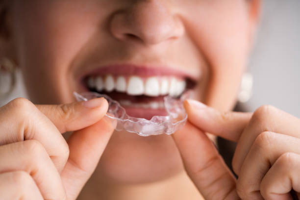 Clear Aligner Dental Night Guard Clear Aligner Dental Night Guard For Teeth dental aligner photos stock pictures, royalty-free photos & images