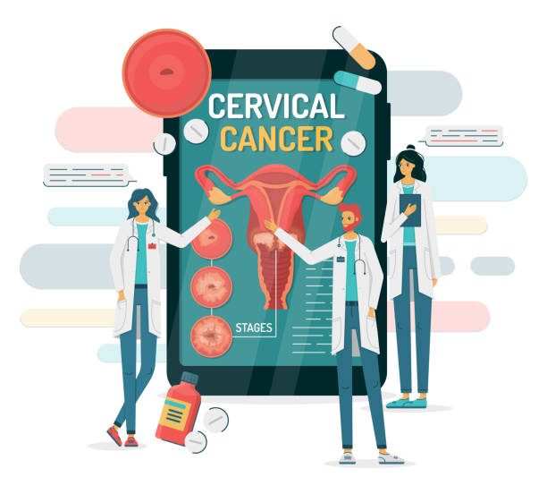 ilustrações de stock, clip art, desenhos animados e ícones de cervical cancer on a smartphone with doctors - red blood cell