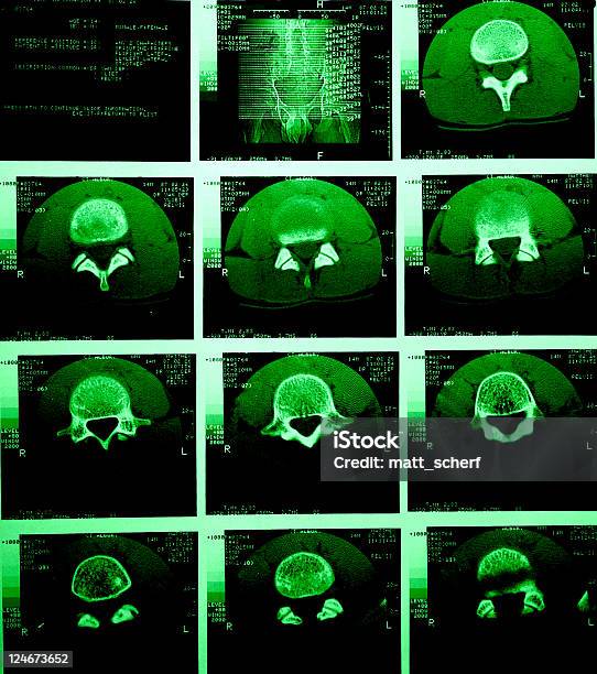 La Tomografía Computarizada De La Pelvis Grunge De Matriz Foto de stock y más banco de imágenes de Tomografía axial computerizada