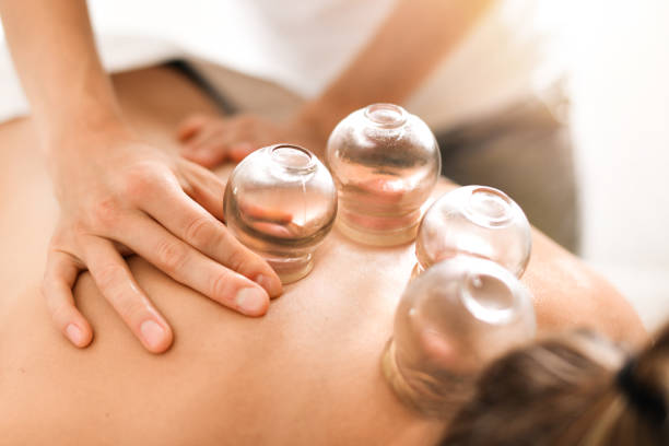Detail of a woman therapist hands giving cupping treatment stock photo